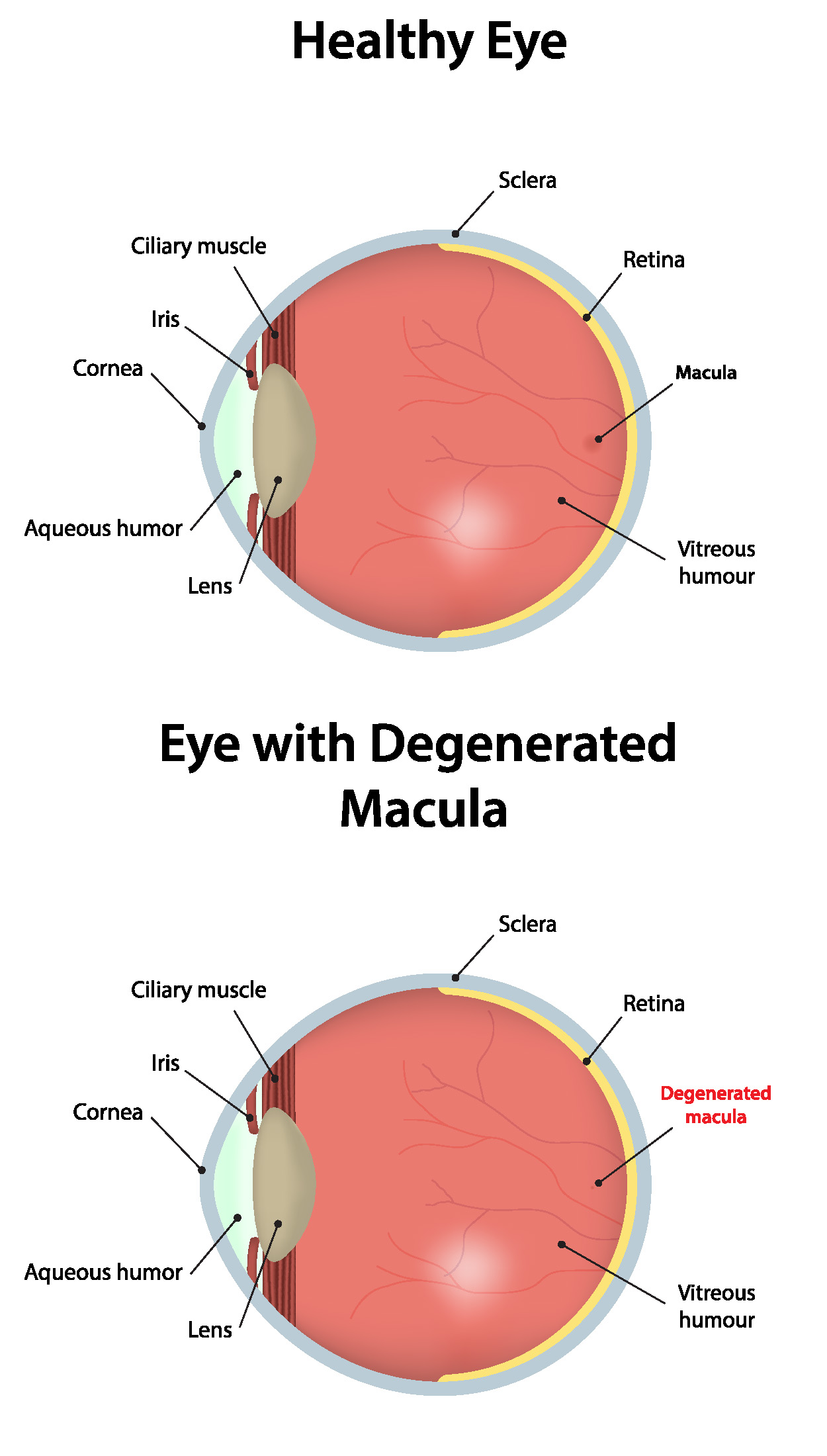 » Macular degeneration. Stop blaming the sun! » Sunlight Institute